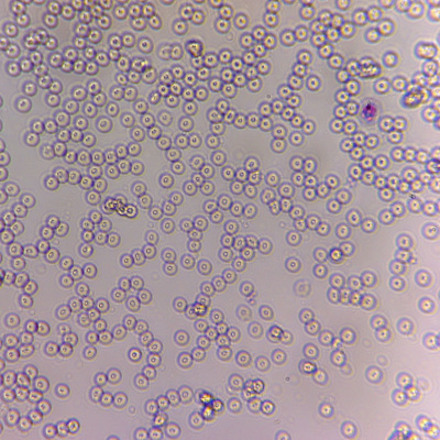 low cost microscopy smartphone sensors