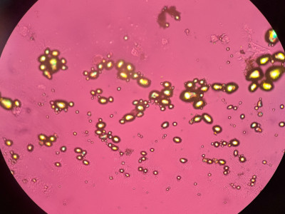 low cost polarization microscopy